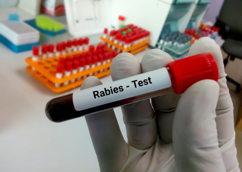 Illustration of rabies blood test